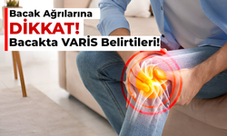 Bacak Ağrılarına Dikkat! Bacakta Varis Belirtileri Neler?