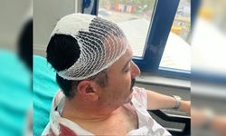 Kahramanmaraş'ta belediyede şekerlikli saldırı: YRP’li yönetici tutuklandı