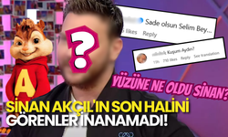 Estetik yaptı, Kuşum Aydın'a Döndü: Sinan Akçıl'ın Son Hali Sosyal Medyayı Salladı!