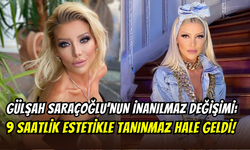 Gülşah Saraçoğlu estetik yapmadı, yüz nakli geçirdi: “Doğal olan sadece saçlarım ve dişlerim”