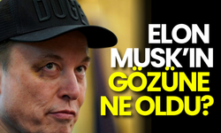 Trump, Elon Musk’a Veda Etti: Musk’ın Morarmış Gözü Olay Oldu!