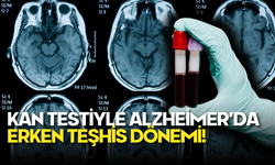 Kan Testiyle Alzheimer’da Erken Teşhis Dönemi