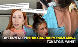 Nihal Candan "Yemek Yeseydi Yaşardı" Yorumlarına Diyetisyenden Tokat Gibi Yanıt!