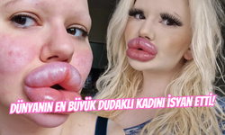 Dünyanın En Büyük Dudaklı Kadını Acı Gerçekle Karşılaştı! Estetik Uğruna 20 Bin Sterlin Harcamış...