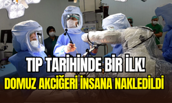Çinli bilim insanları, domuz akciğerini insana nakletti