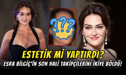 Esra Bilgiç’in Son Hali Takipçilerini İkiye Böldü! Estetik Sırrı Ortaya Çıktı…