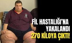 Fil Hastalığı’na Yakalandı: 270 Kilo Oldu