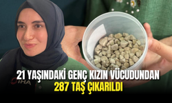21 Yaşındaki Genç Kızın Vücudundan 287 Taş Çıkarıldı, Doktorlar Şaşkın