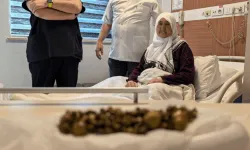 Bursa’da 77 Yaşındaki Kadının Safra Kesesinden 213 Taş Çıkarıldı