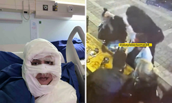 Kadıköy’de Korkunç Olay: Genç Kadın Başka Bir Kadın Tarafından Ateşe Verildi!