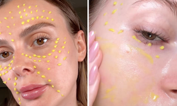 Retinol/Retinal nedir, nasıl kullanılır?