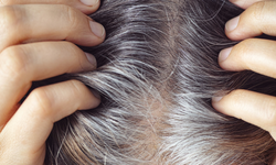 Bilim saç beyazlamasını tersine çevirebilir mi? İlk bulgular geldi