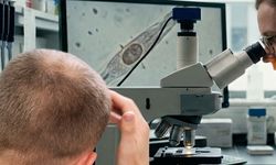 Kellik tarihe karışıyor: Yan etkisiz yeni ilaçta "%539'luk saç artışı" görüldü!