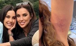 Dilan Polat–Sıla Doğu gerilimi darp iddiasıyla patladı