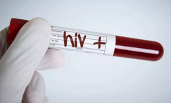 Farkında olmadan HIV ile yaşamak: Türkiye’de artış sürüyor