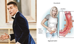Murat Cemcir'in hastalığı: Divertikül kanaması nedir?