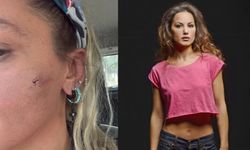 Oyuncu Yıldız Asyalı’dan şoke eden iddia: “Eşim tarafından darp edildim”