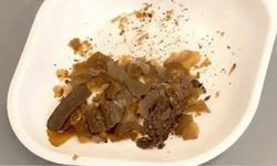 Galen’in dışkı ve kekik karışımıyla tedavi uyguladığı kanıtlandı