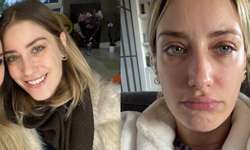 Hazal Kaya’nın doğal hali sosyal medyada öne çıktı