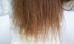 Yanmış ve yıpranmış saçları canlandıracak en etkili 3 yöntem