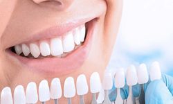 Doğal diş beyazlatma yöntemleri işe yarıyor mu?