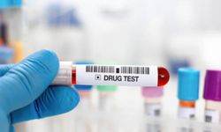 Şirketlerden radikal karar: İşe alımda uyuşturucu testi zorunlu
