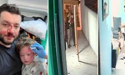 Yalova'da 14 aylık bebek ve babasına saldırı da iddianame hazırlandı