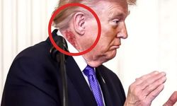 Trump’ın boynundaki kızarıklığın nedeni belli oldu