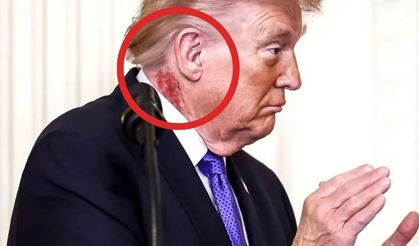 Trump’ın boynundaki kızarıklığın nedeni belli oldu