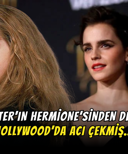 Harry Potter’ın Hermione’si Açtı Ağzını Yumdu Gözünü: Hollywood’da Acı Çekmiş!