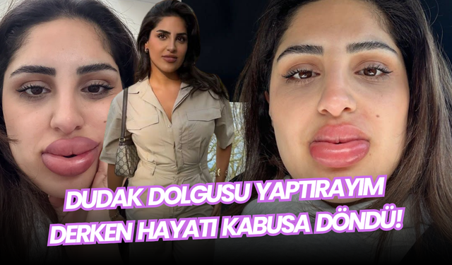 Dudak Dolgusu Yaptırayım Derken Hayatı Kabusa Döndü!