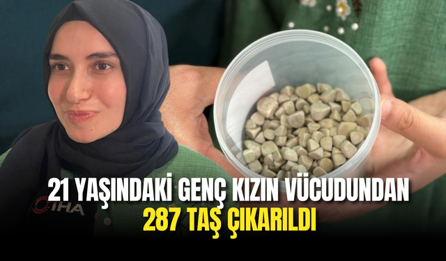 21 Yaşındaki Genç Kızın Vücudundan 287 Taş Çıkarıldı, Doktorlar Şaşkın