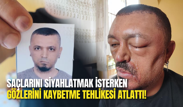 İnternetten Aldığı Şampuan Hayatını Kabusa Çevirdi!
