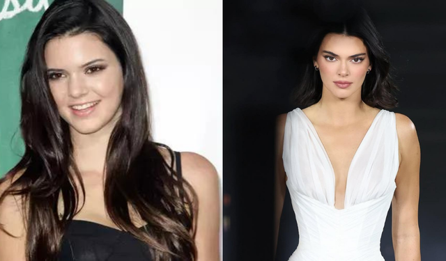 Kendall Jenner’in estetik açıklaması gündem oldu