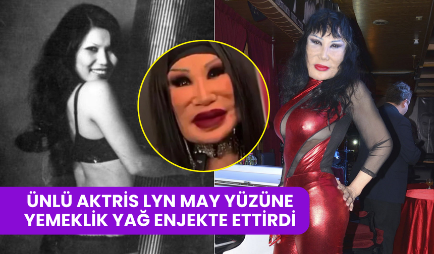 Estetik Faciası: Ünlü Aktris Lyn May Yüzüne Yemeklik Yağ Enjekte Ettirdi