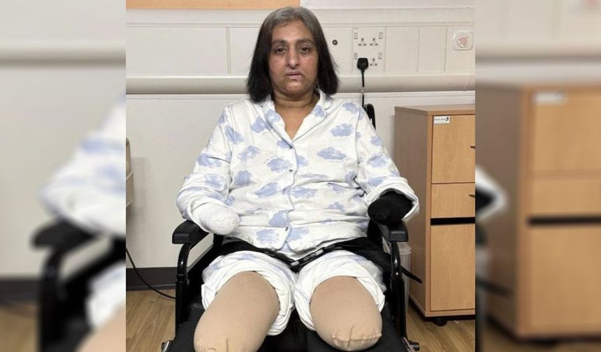 Köpeğinin yalaması hayatını kararttı: Talihsiz kadın dört uzvunu birden kaybetti!