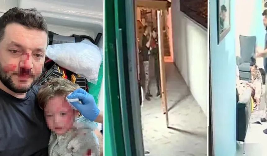 14 aylık bebeği yaralayan komşu hakkında iddianame hazırlandı