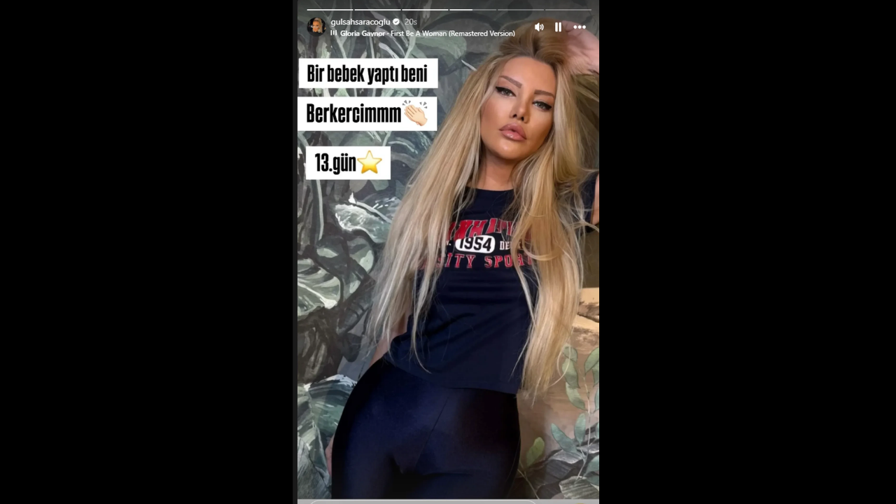 Gülşah Saraçoğlu Estetik Yapmadı, Yüz Nakli Geçirdi “Doğal Olan Sadece Saçlarım Ve Dişlerim” (3)