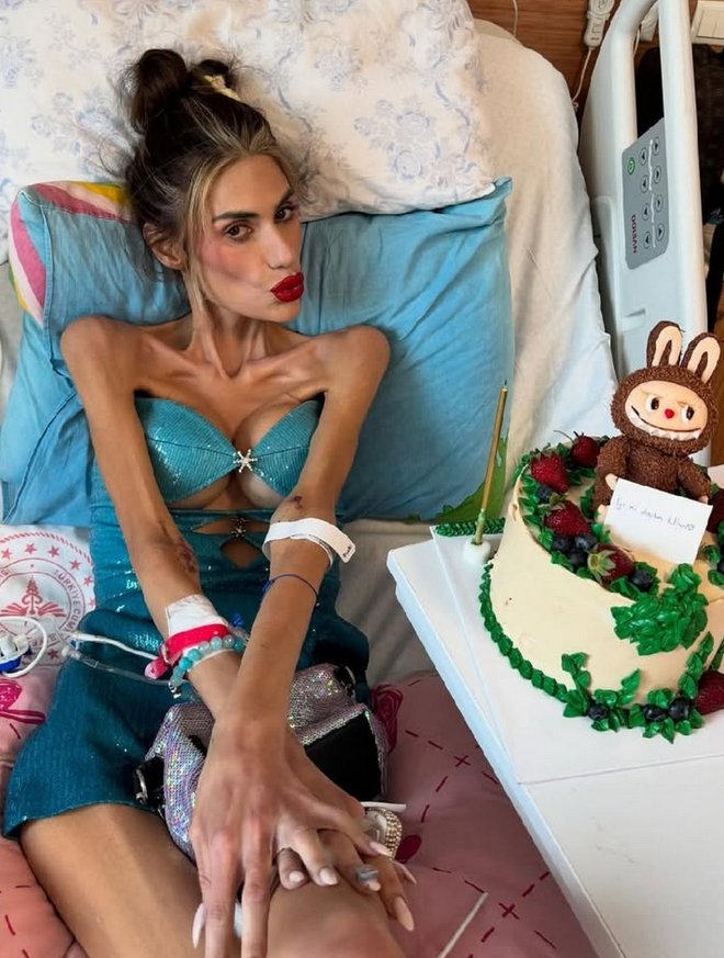 Anoreksiya Nedeniyle 23 Kiloya Düşen Nihal Candan Hayatını Kaybetti!-3