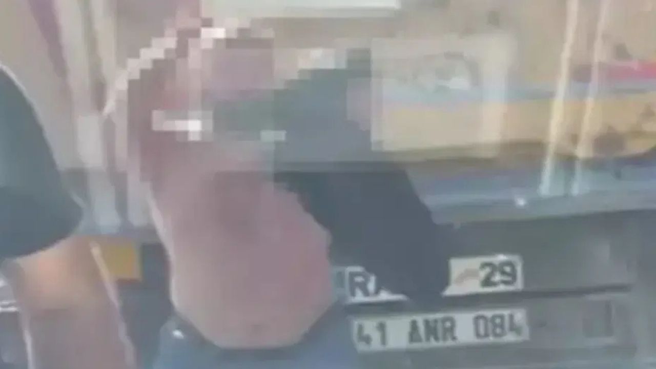 Genç Oyuncu Trafikte Saldırıya Uğradı! (2)