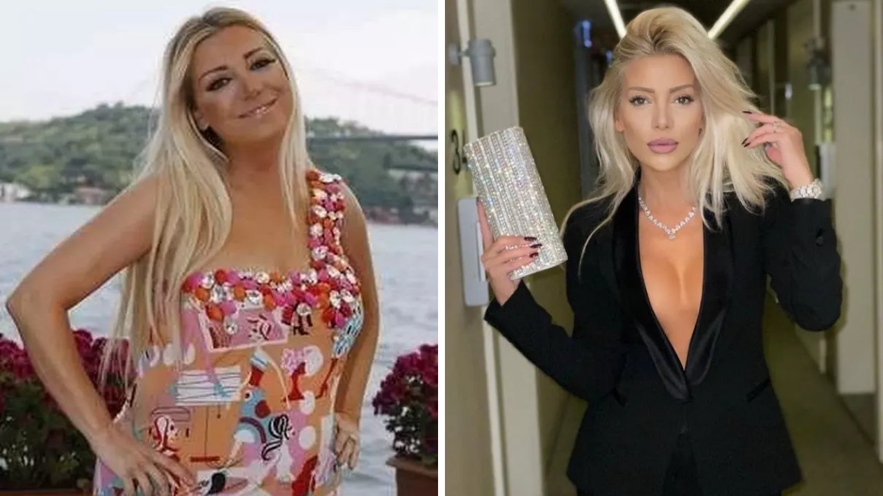 Gülşah Saraçoğlu, 9 Saatlik Estetik Operasyon Oldu Bambaşka Birine Dönüştü! (1)-1