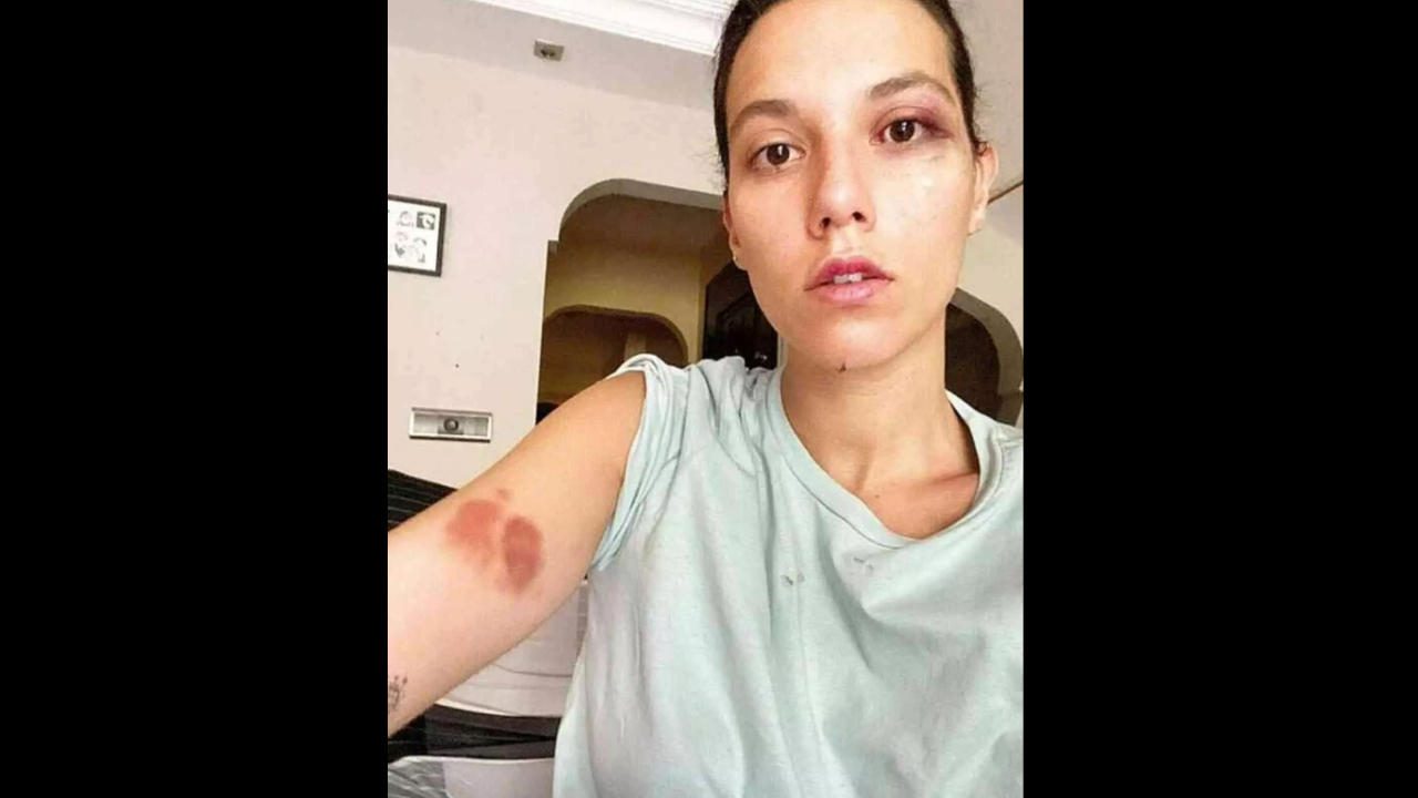 Ozan Güven’in Deniz Bulutsuz Davası Sonuçlandı Kasten Yaralamadan 1 Yıl 15 Ay Ceza