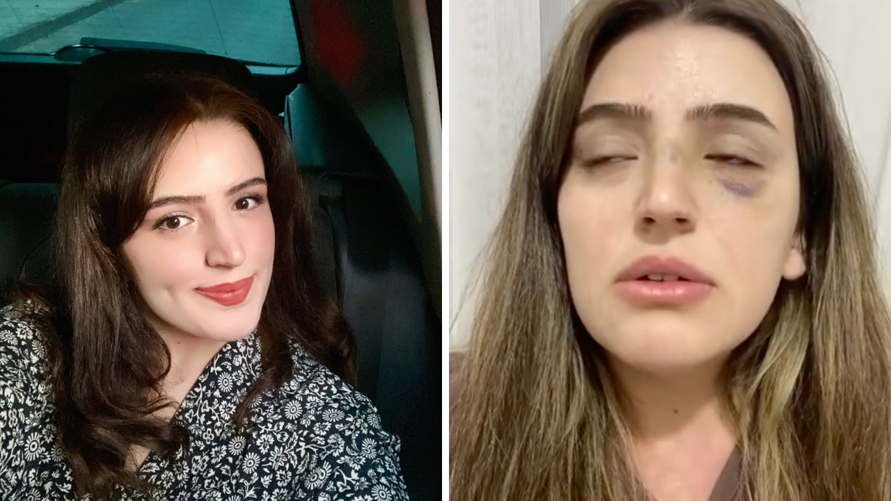 Teğmen Eşinden Şiddet Gören Kadın Sosyal Medyada Yardım İstedi! (2)