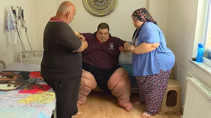 Fil Hastalığı’na Yakalandı 270 Kilo Oldu