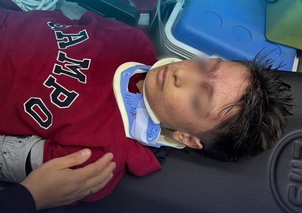 Erzurum’da Okulda Izdiham 23 Öğrenci Yaralandı