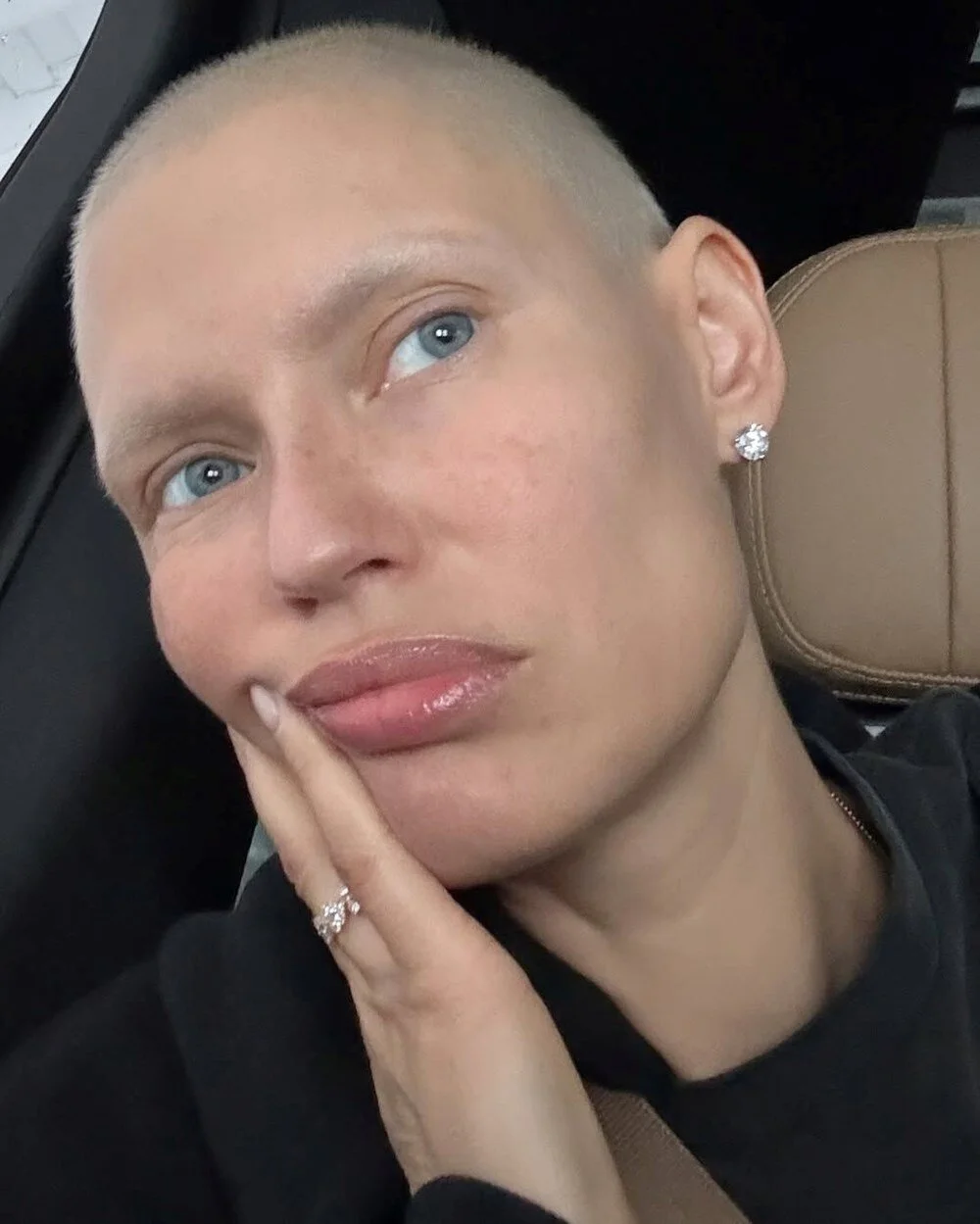 Eski Victoria's Secret Meleği Kanserle Mücadele Ediyor! 1