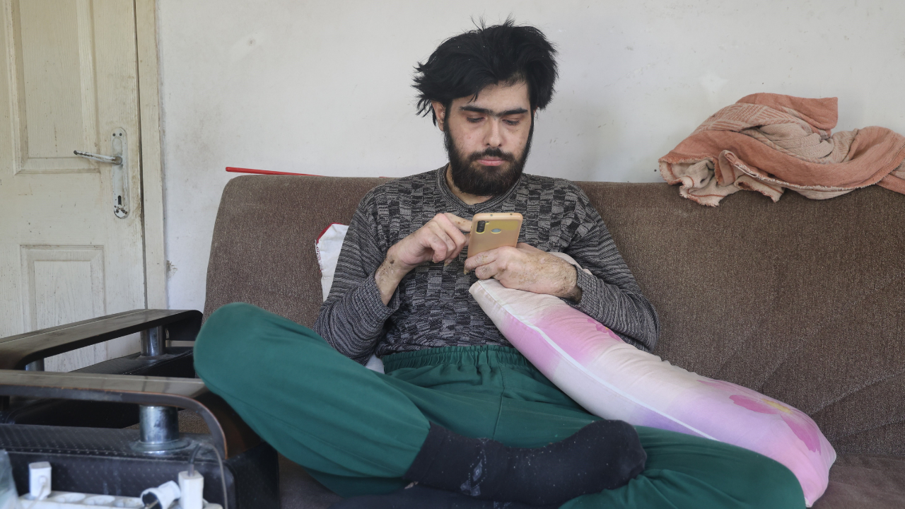 Hatay’daki Telefon Bağımlısı Genç 3 Yıl Sonra Ilk Kez Dışarı Çıktı Tıraş Oldu, Duş Aldı (6)
