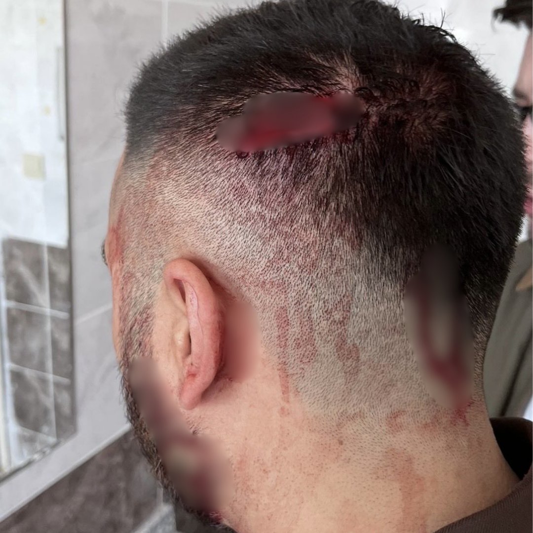 Öğretmene Sopayla Saldıran Veli Tutuklandı! 1