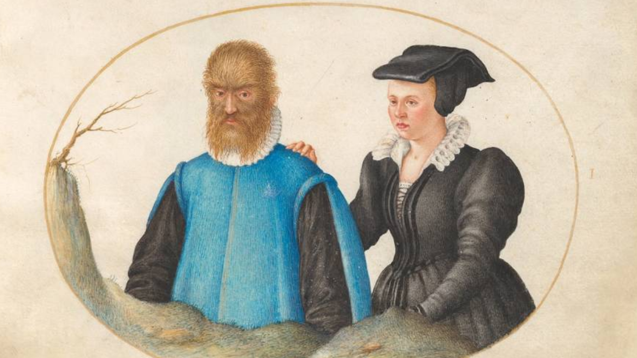 Güzel Ve Çirkin Masalına Ilham Olan Adam Petrus Gonsalvus! (2)