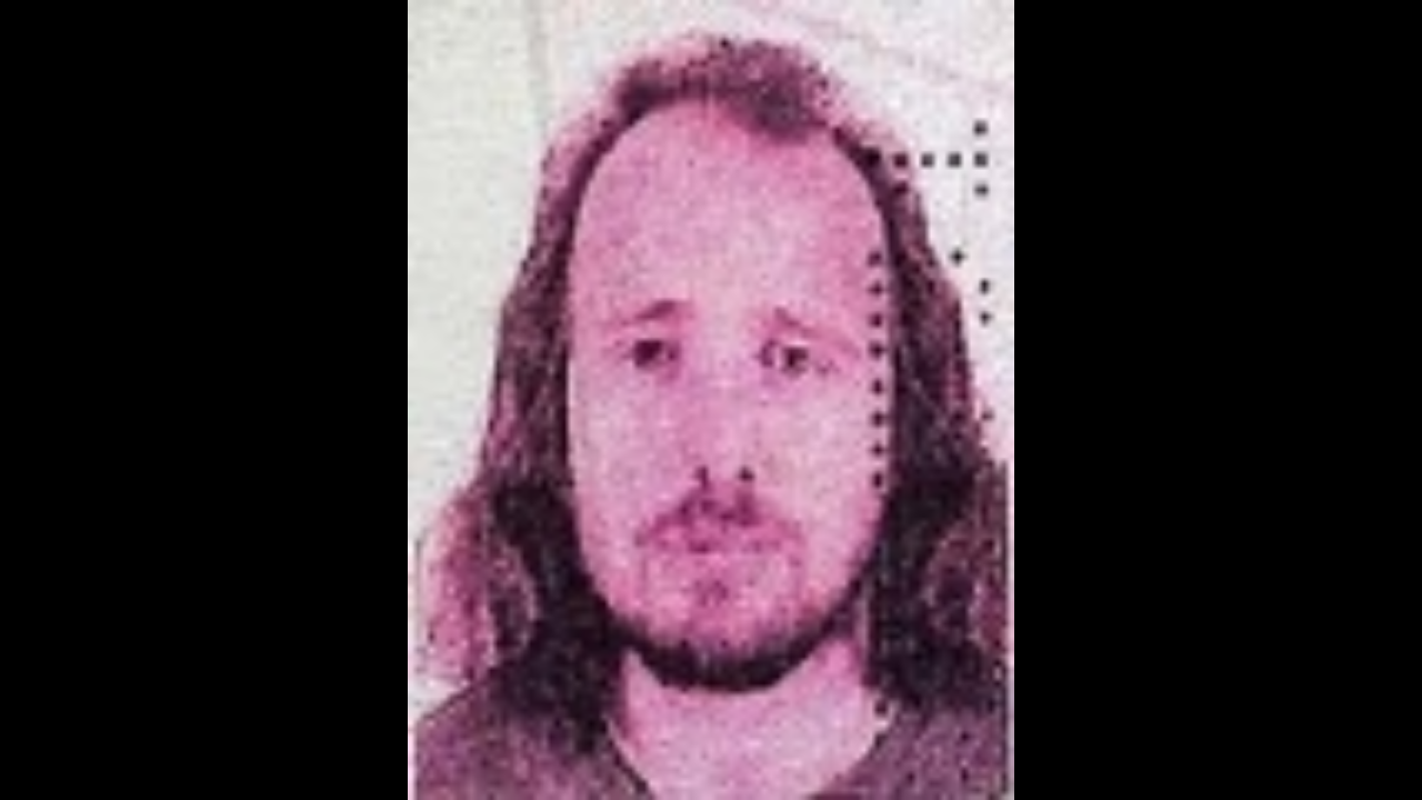 İstanbul’a Saç Ekimi Ve Diş Tedavisi Için Gelen İngiliz Vatandaşı Mentor Rama Hayatını Kaybetti